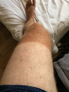 My tan seems to be coming along nicely - in places!